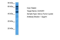 CCHCR1 Rabbit anti-Human, Polyclonal, Novus Biologicals 0.1 mL | Buy Online | Novus Biologicals | Fisher Scientific
